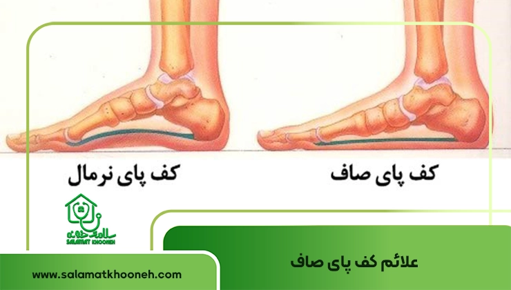 علائم کف پای صاف