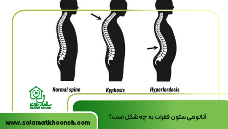 انواع مشکلات ستون فقرات