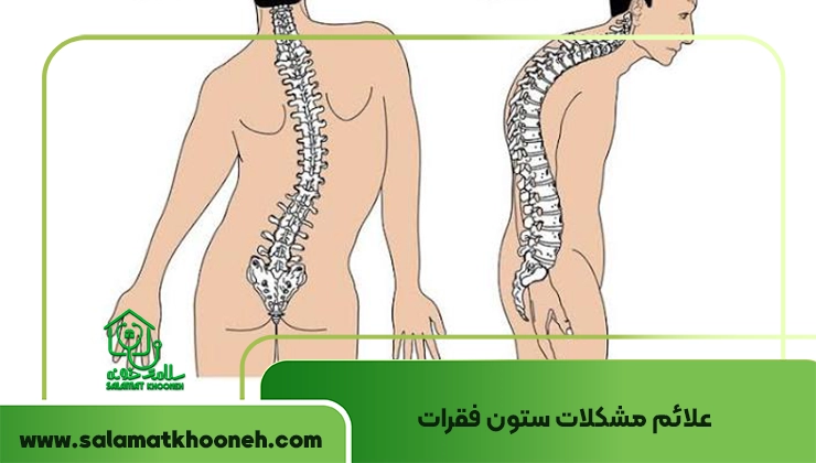 علائم مشکلات ستون فقرات