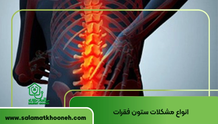 انواع مشکلات ستون فقرات