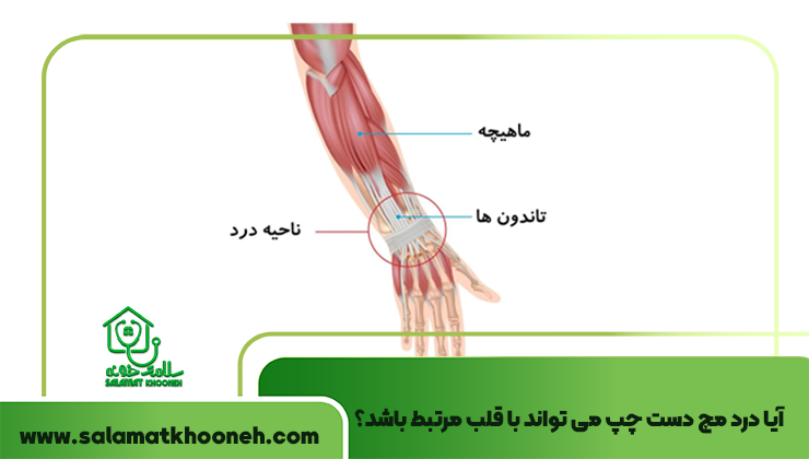 آیا درد مچ دست چپ می تواند با قلب مرتبط باشد؟