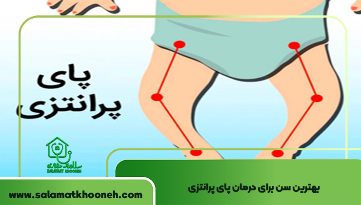 بهترین سن برای درمان پای پرانتزی