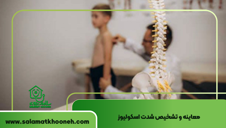 معاینه و تشخیص شدت اسکولیوز
