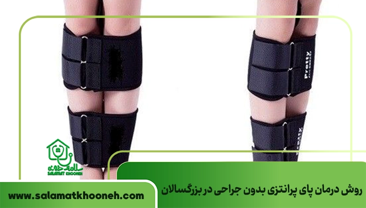 Non-surgical treatment of clubfoot in adults