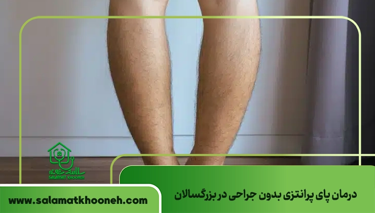 درمان پای پرانتزی بدون جراحی در بزرگسالان