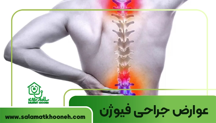 عوارض فیوژن ستون فقرات