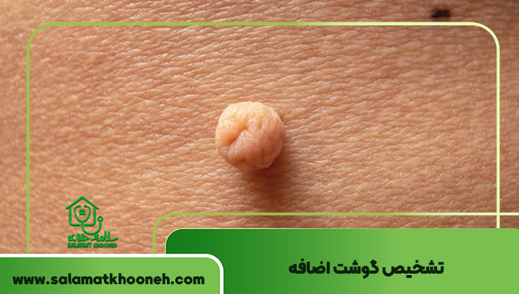تشخیص گوشت اضافه
