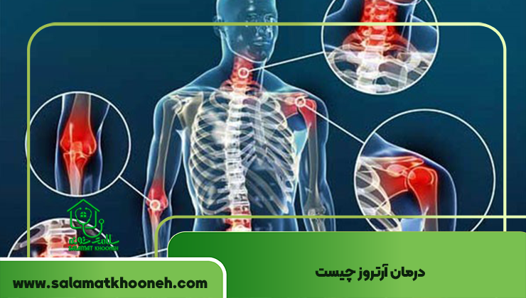 درمان آرتروز چیست