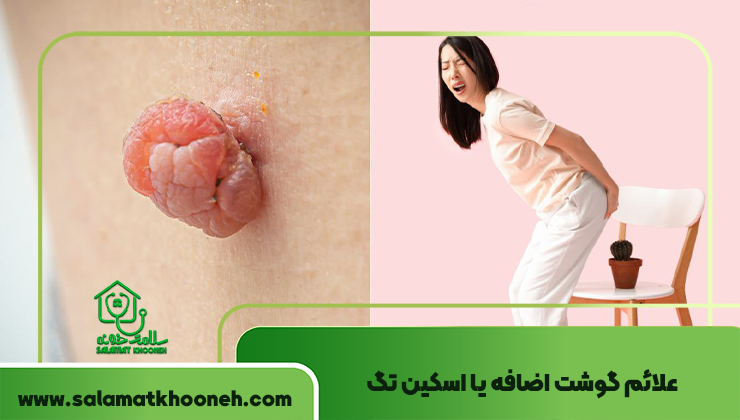 علائم گوشت اضافه یا اسکین تگ