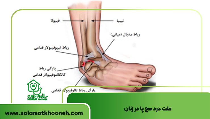 علت درد مچ پا در زنان