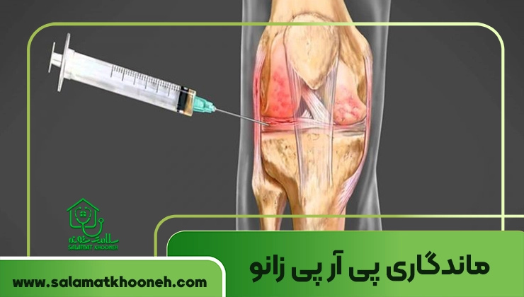 ماندگاری پی آر پی زانو