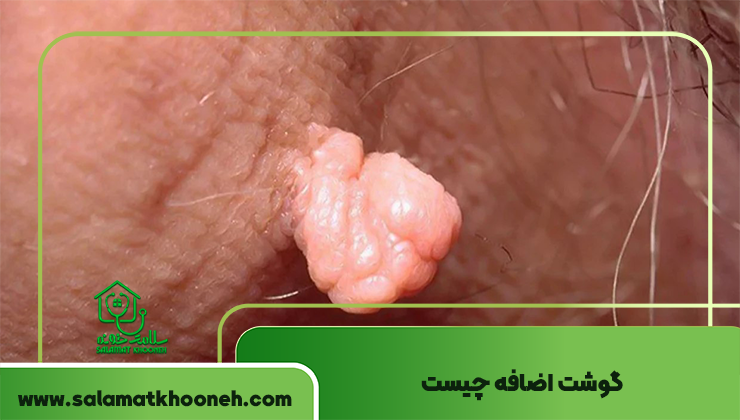 گوشت اضافه چیست