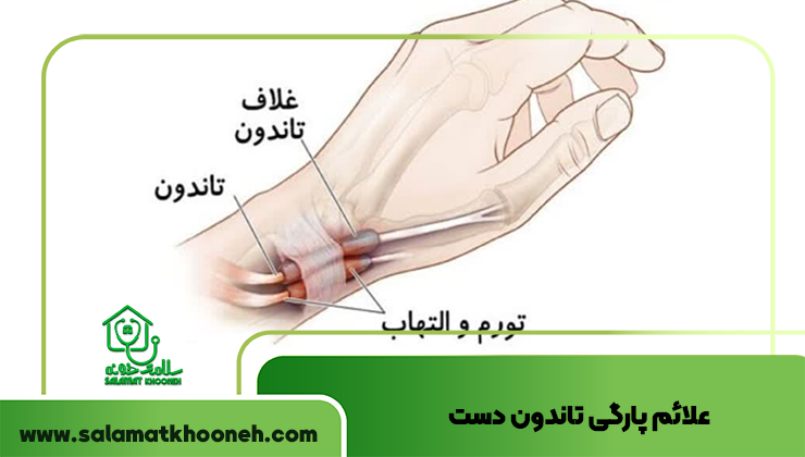 آناتومی تاندون های دست