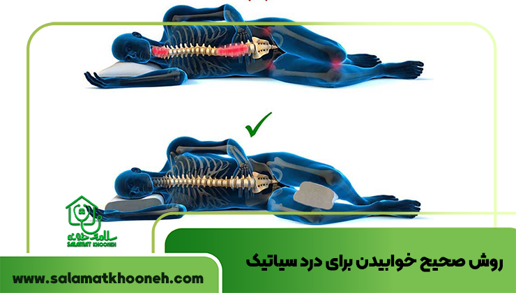 بهترین روش خوابیدن برای درد سیاتیک