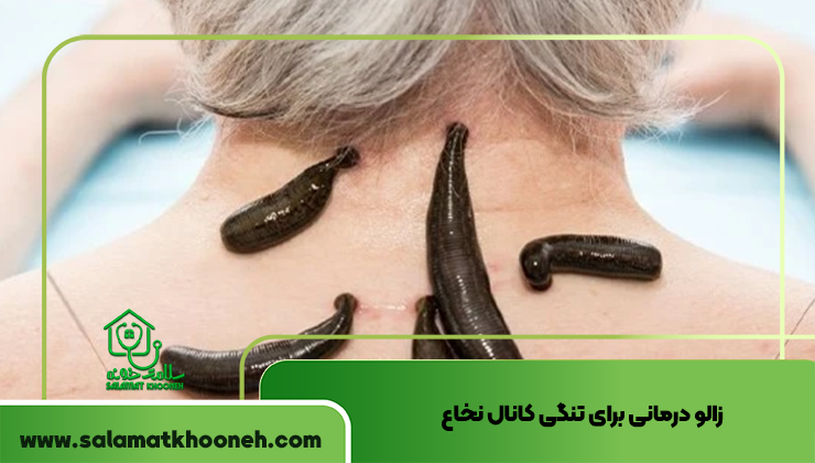 زالو درمانی برای تنگی کانال نخاع