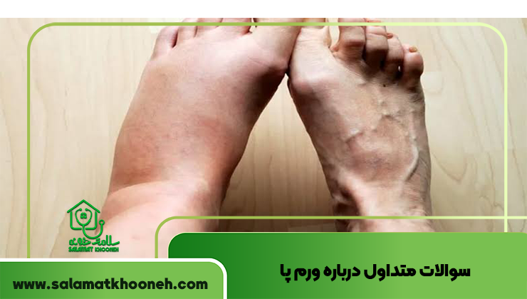 سوالات متداول درباره ورم پا