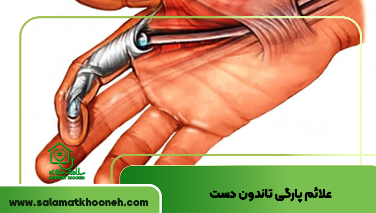 علائم پارگی تاندون دست