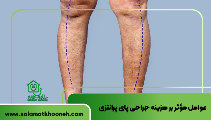 عوامل مؤثر بر هزینه جراحی پای پرانتزی