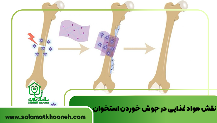 نقش مواد غذایی در جوش خوردن استخوان