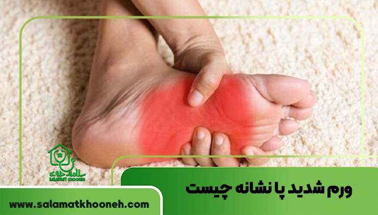 ورم شدید پا نشانه چیست