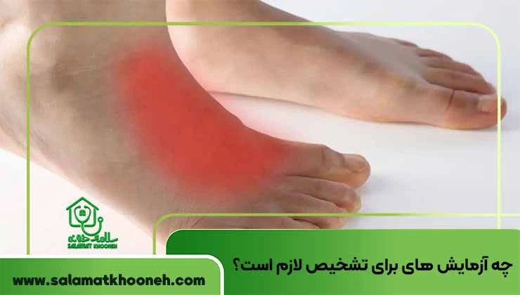 چه آزمایش ها و تصویربرداری هایی برای تشخیص لازم است؟