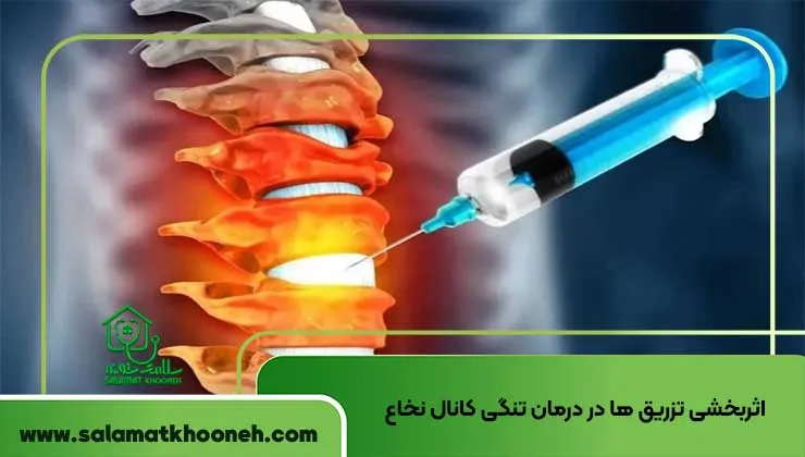 اثربخشی تزریق ها در درمان تنگی کانال نخاع