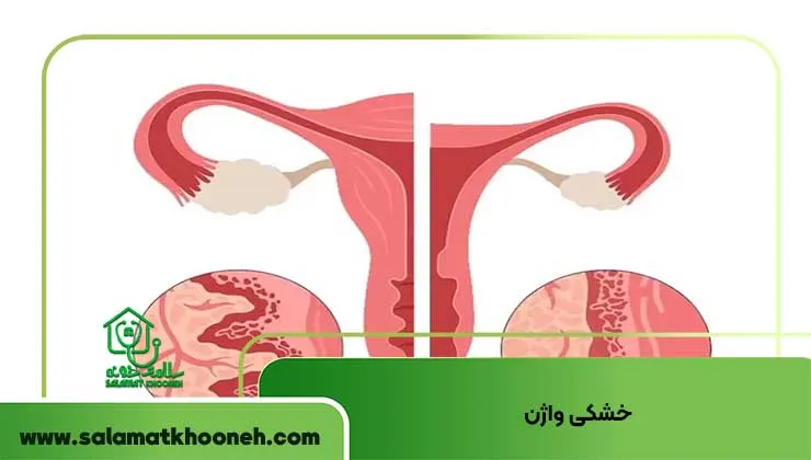 خشکی واژن از دلایل شایع خونریزی بعد از رابطه جنسی