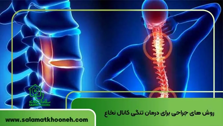روش های جراحی برای درمان تنگی کانال نخاع