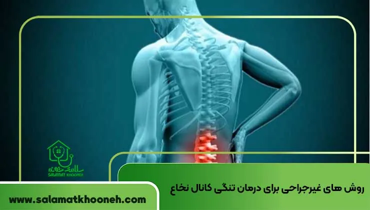 روش های غیرجراحی برای درمان تنگی کانال نخاع