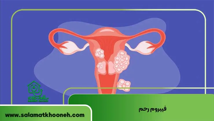 فیبروم رحم از دلایل شایع خونریزی بعد از رابطه جنسی