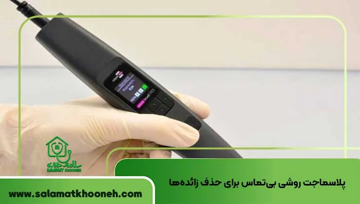 پلاسماجت روشی بی_تماس برای حذف زائده_ها