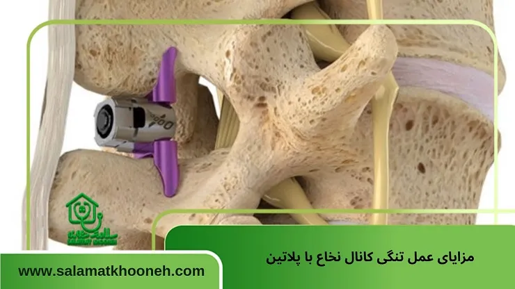 مزایای عمل تنگی کانال نخاع با پلاتین