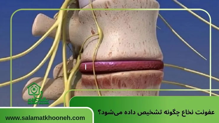 عفونت نخاع چگونه تشخیص داده میشود؟
