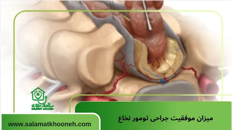 میزان موفقیت جراحی تومور نخاع