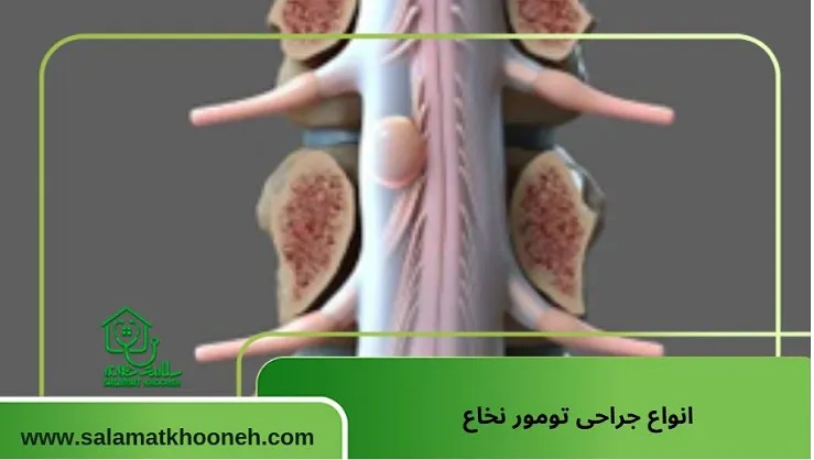 انواع جراحی تومور نخاع