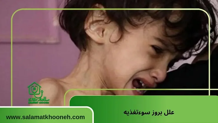 علل بروز سوءتغذیه