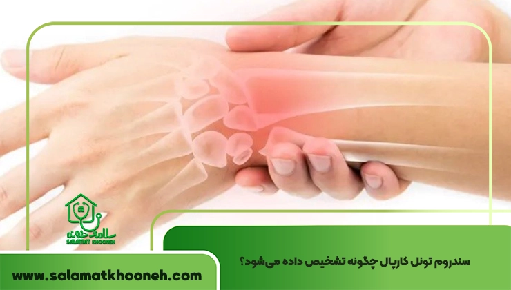 تشخیص سندروم تونل کارپال