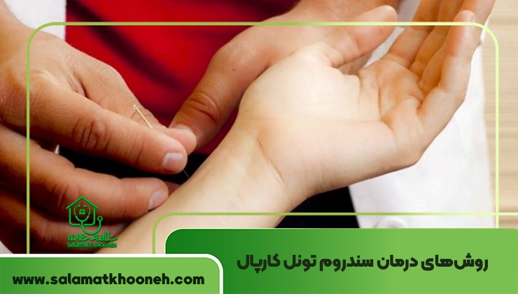 درمان سندروم تونل کارپال