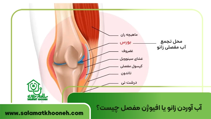 آب آوردن زانو