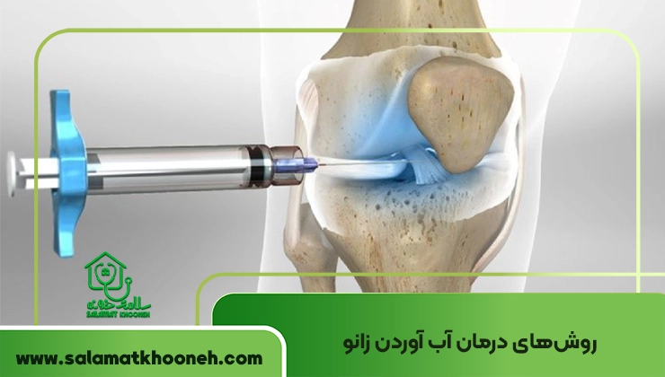 درمان آب آوردن زانو