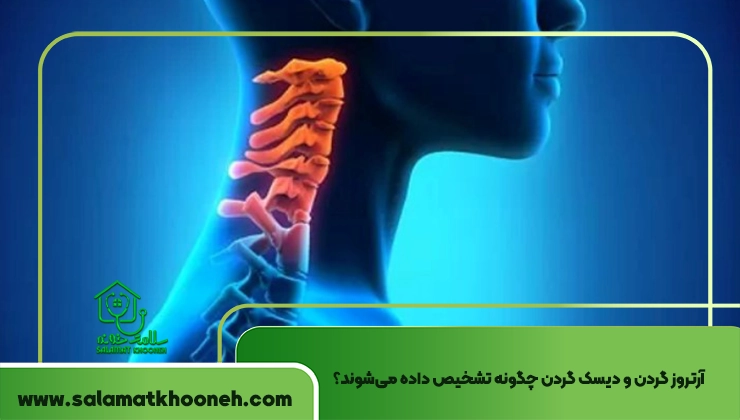 فرق آرتروز گردن و دیسک گردن
