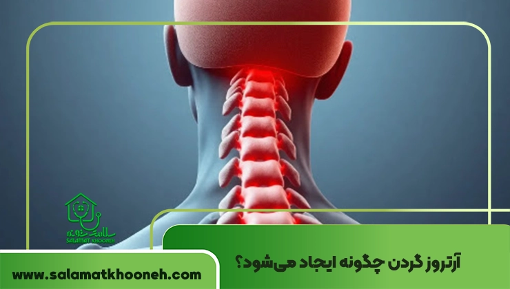 آرتروز گردن