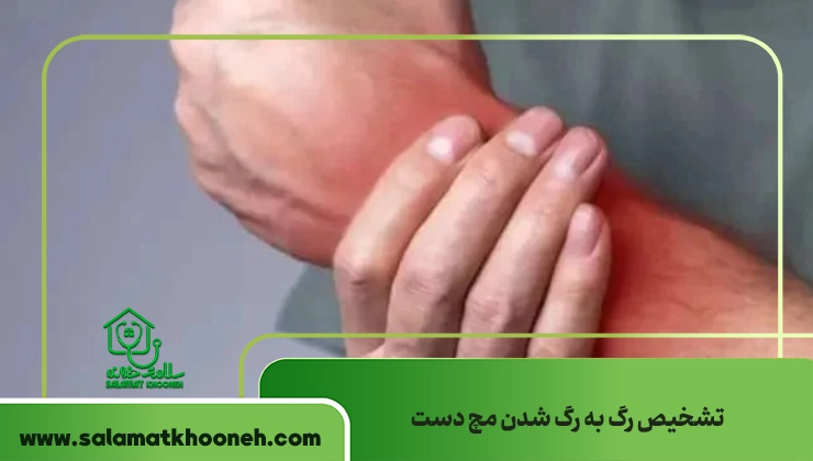 تشخیص رگ به رگ شدن مچ دست