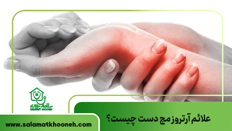 علائم آرتروز مچ دست