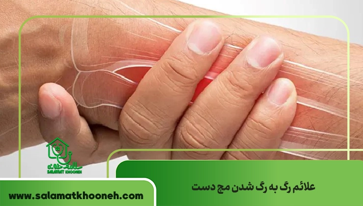 علائم رگ به رگ شدن مچ دست