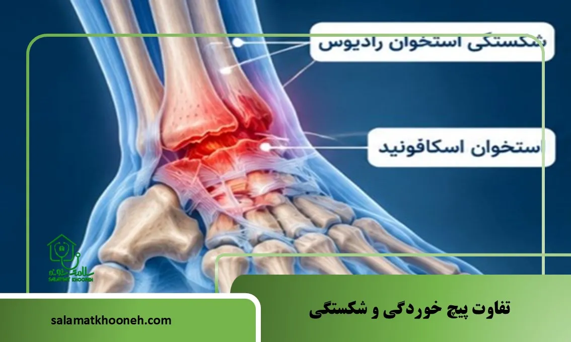 تفاوت پیچ خوردگی و شکستگی