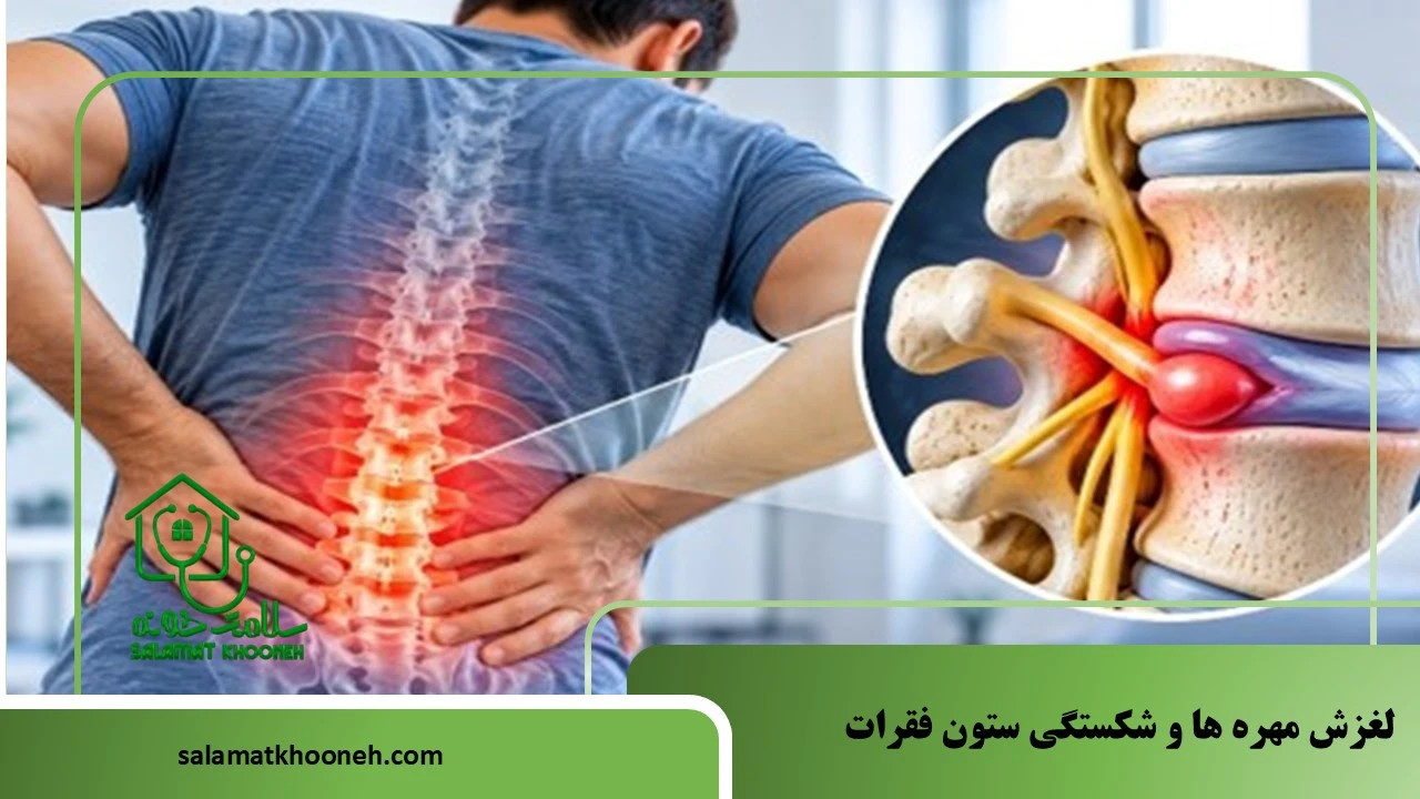 لغزش مهره_ها وشکستگی ستون فقرات